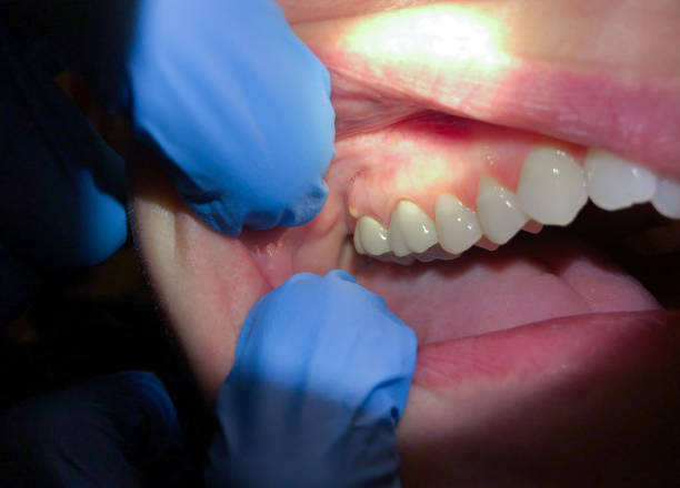 Best Tooth Infection Emergency Dentist  in Grand Rapids, MI